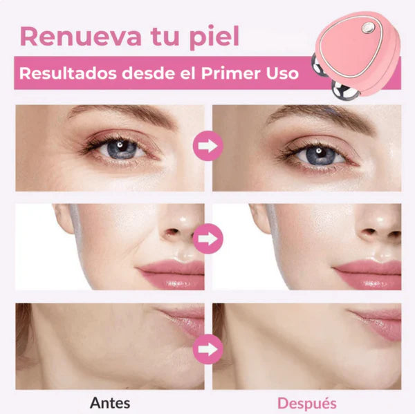 Masajeador Facial + Serum Ácido Hialuronico de REGALO!